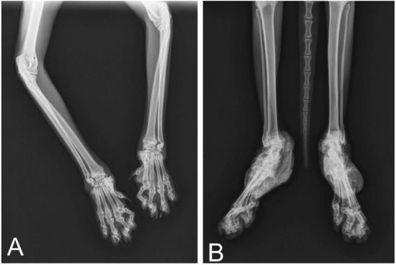 radiographie ostéochondrodysplasie du Scottish Fold